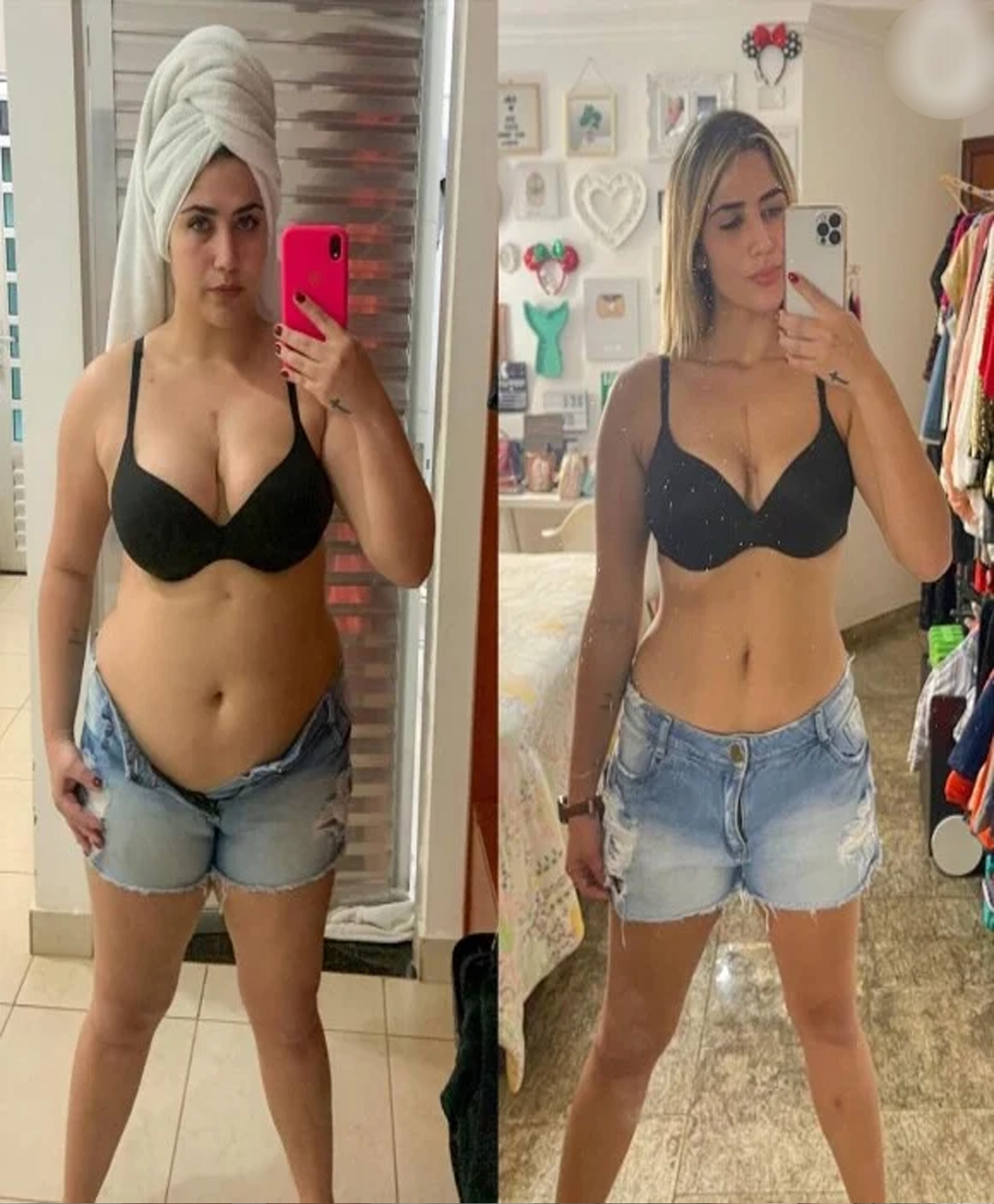 Antes Depois 01