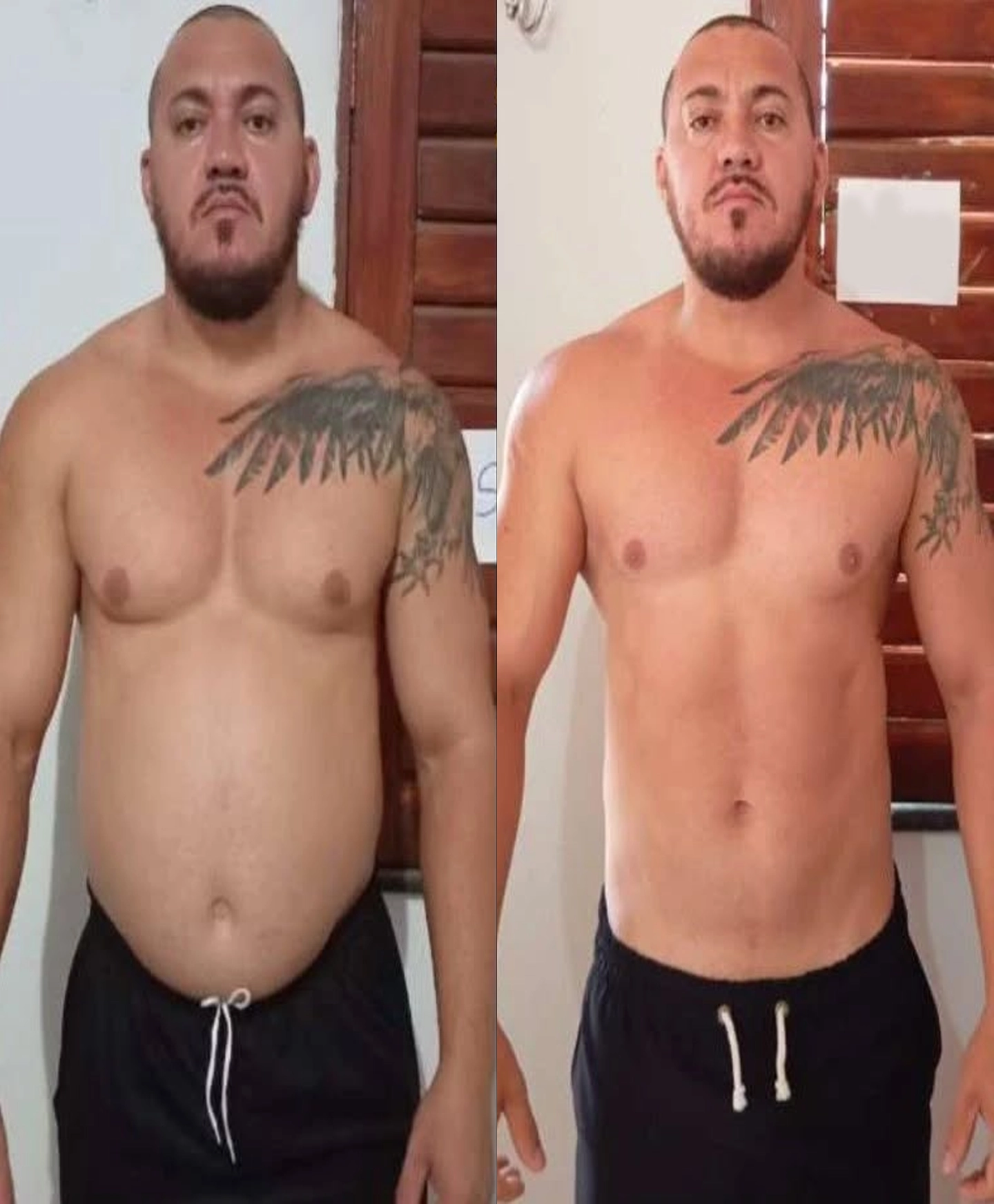 Antes Depois 03