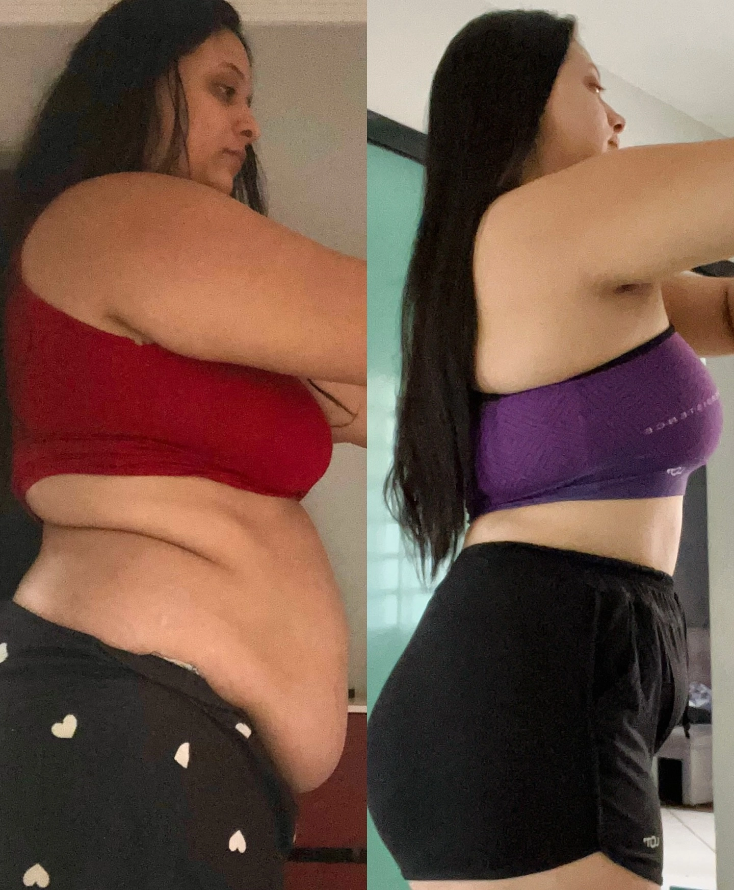 Antes Depois 04